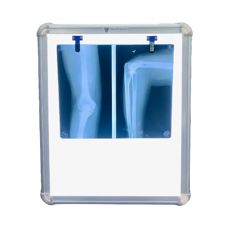 X Ray View Box Single Film with Sensor